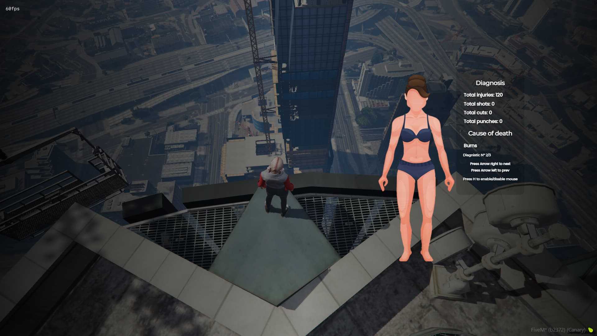 Body Damages System V2 [Standalone]