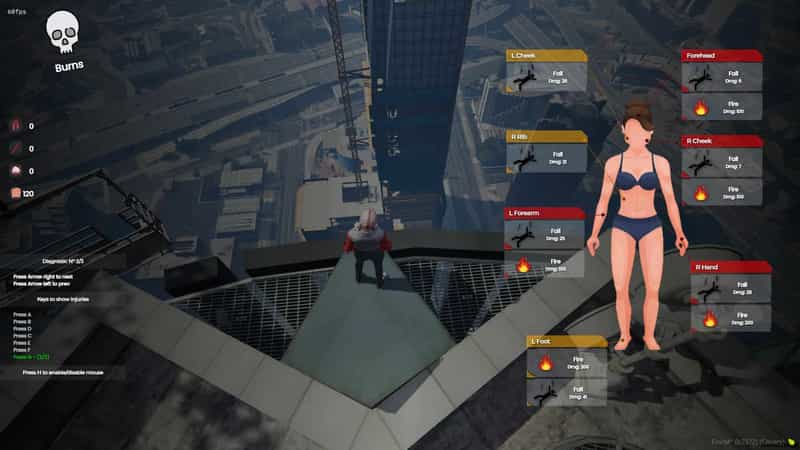 Body Damages System V2 [Standalone]